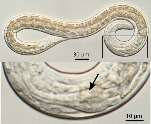 Parasitic nematodes