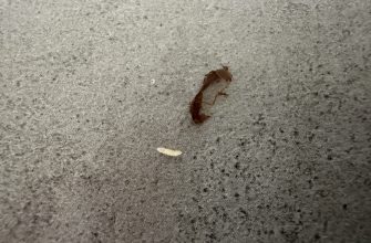 Worms